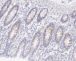 Invitrogen DVL2 Recombinant Rabbit Monoclonal Antibody (PSH04-07) 100 &mu;L;