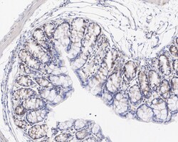 Invitrogen DVL2 Recombinant Rabbit Monoclonal Antibody (PSH04-07) 100 &mu;L;