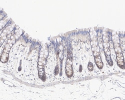 Invitrogen DVL2 Recombinant Rabbit Monoclonal Antibody (PSH04-07) 100 &mu;L;