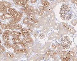 Invitrogen Tau Recombinant Rabbit Monoclonal Antibody (PSH05-50) 100 &mu;L;