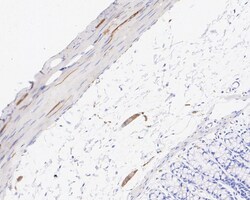 Invitrogen Tau Recombinant Rabbit Monoclonal Antibody (PSH05-50) 100 &mu;L;