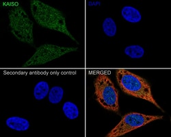 Invitrogen Kaiso Recombinant Rabbit Monoclonal Antibody (JE38-42) 100 &mu;L;