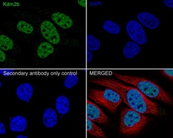 Invitrogen FBXL10 Recombinant Rabbit Monoclonal Antibody (PSH05-38) 100