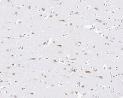 Invitrogen FBXL10 Recombinant Rabbit Monoclonal Antibody (PSH05-38) 100