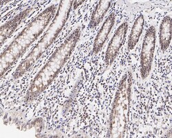 Invitrogen FBXL10 Recombinant Rabbit Monoclonal Antibody (PSH05-38) 100