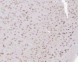 Invitrogen FBXL10 Recombinant Rabbit Monoclonal Antibody (PSH05-38) 100