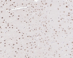 Invitrogen FBXL10 Recombinant Rabbit Monoclonal Antibody (PSH05-38) 100