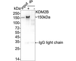 Invitrogen FBXL10 Recombinant Rabbit Monoclonal Antibody (PSH05-38) 100