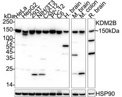 Invitrogen FBXL10 Recombinant Rabbit Monoclonal Antibody (PSH05-38) 100
