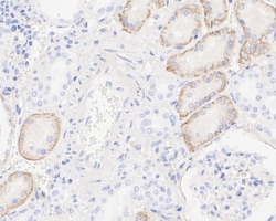 Invitrogen K-cadherin Recombinant Rabbit Monoclonal Antibody (JE40-27)