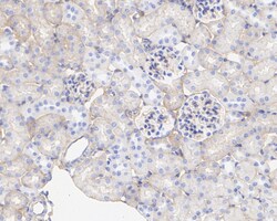 Invitrogen K-cadherin Recombinant Rabbit Monoclonal Antibody (JE40-27)