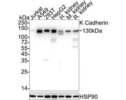 Invitrogen K-cadherin Recombinant Rabbit Monoclonal Antibody (JE40-27)