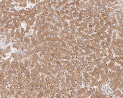 Invitrogen AGL Recombinant Rabbit Monoclonal Antibody (PSH04-56) 100 &mu;L;