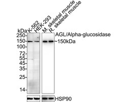 Invitrogen AGL Recombinant Rabbit Monoclonal Antibody (PSH04-56) 100 &mu;L;