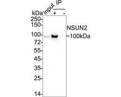Invitrogen NSUN2 Recombinant Rabbit Monoclonal Antibody (PSH05-05) 100