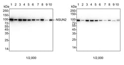 Invitrogen NSUN2 Recombinant Rabbit Monoclonal Antibody (PSH05-05) 100