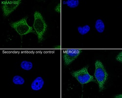 Invitrogen KIAA0100 Recombinant Mouse Monoclonal Antibody (A0-F3-R) 100