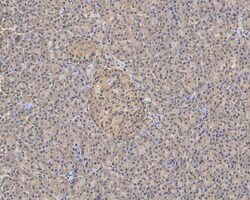 Invitrogen KIAA0100 Recombinant Mouse Monoclonal Antibody (A0-F3-R) 100