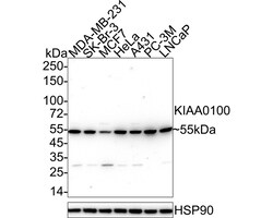 Invitrogen KIAA0100 Recombinant Mouse Monoclonal Antibody (A0-F3-R) 100