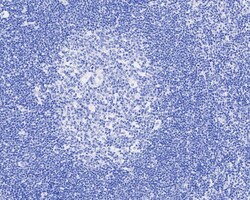 Invitrogen Digoxin Recombinant Rabbit Monoclonal Antibody (PSH04-40) 100