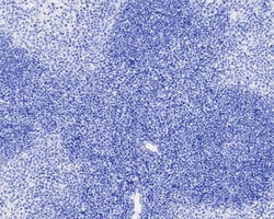 Invitrogen Digoxin Recombinant Rabbit Monoclonal Antibody (PSH04-40) 100