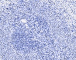 Invitrogen Digoxin Recombinant Rabbit Monoclonal Antibody (PSH04-40) 100