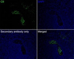 Invitrogen Complement C9 Recombinant Rabbit Monoclonal Antibody (JE01-45)