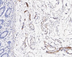 Invitrogen Complement C9 Recombinant Rabbit Monoclonal Antibody (JE01-45)