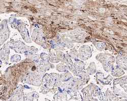 Invitrogen Complement C9 Recombinant Rabbit Monoclonal Antibody (JE01-45)