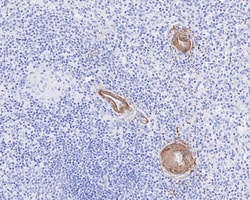 Invitrogen Complement C9 Recombinant Rabbit Monoclonal Antibody (JE01-45)