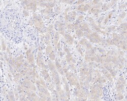 Invitrogen CAD Recombinant Rabbit Monoclonal Antibody (JE33-26) 100 &mu;L;