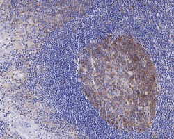 Invitrogen CAD Recombinant Rabbit Monoclonal Antibody (JE33-26) 100 &mu;L;