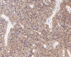 Invitrogen GPR56 Recombinant Rabbit Monoclonal Antibody (PSH05-43) 100