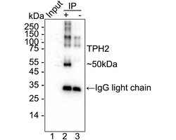 Invitrogen TPH2 Recombinant Rabbit Monoclonal Antibody (PSH04-89) 100 &mu;L;