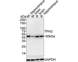 Invitrogen TPH2 Recombinant Rabbit Monoclonal Antibody (PSH04-89) 100 &mu;L;