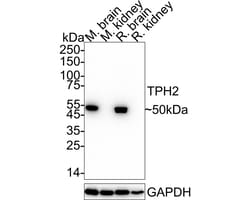 Invitrogen TPH2 Recombinant Rabbit Monoclonal Antibody (PSH04-89) 100 &mu;L;