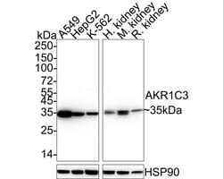 Invitrogen AKR1C3 Recombinant Rabbit Monoclonal Antibody (JE36-28) 100