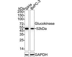 Invitrogen GCK Recombinant Rabbit Monoclonal Antibody (JE33-40) 100 &mu;L;