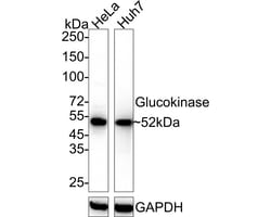 Invitrogen GCK Recombinant Rabbit Monoclonal Antibody (JE33-40) 100 &mu;L;