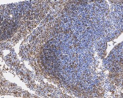 Invitrogen Caspase 1 p10/p12 Recombinant Rabbit Monoclonal Antibody (JE56-35)