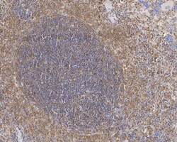 Invitrogen Caspase 1 p10/p12 Recombinant Rabbit Monoclonal Antibody (JE56-35)