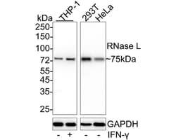 Invitrogen RNaseL Recombinant Rabbit Monoclonal Antibody (JE36-11) 100