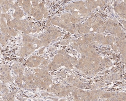 Invitrogen Caspase 3 p12 Recombinant Rabbit Monoclonal Antibody (JE07-51)
