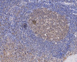 Invitrogen Caspase 3 p12 Recombinant Rabbit Monoclonal Antibody (JE07-51)