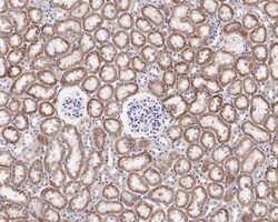 Invitrogen Caspase 3 p12 Recombinant Rabbit Monoclonal Antibody (JE07-51)