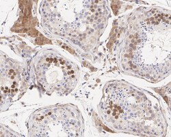 Invitrogen MUNC18 Recombinant Rabbit Monoclonal Antibody (JE38-54) 100