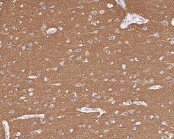 Invitrogen MUNC18 Recombinant Rabbit Monoclonal Antibody (JE38-54) 100