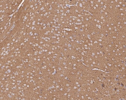 Invitrogen MUNC18 Recombinant Rabbit Monoclonal Antibody (JE38-54) 100