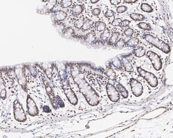 Invitrogen H3K4me2 Recombinant Rabbit Monoclonal Antibody (JE00-98) 100