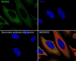Invitrogen ROCK2 Recombinant Rabbit Monoclonal Antibody (JE31-36) 100 &mu;L;